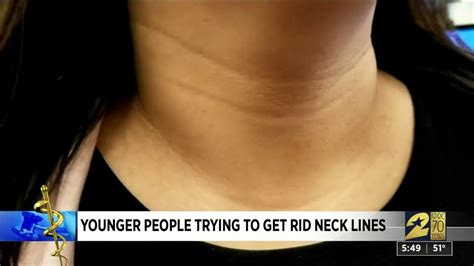 How To Get Rid Of Tech Neck — Creases In Your Neck That Arent Caused