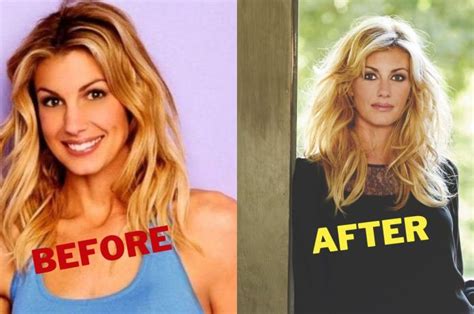 Faith Hill Plastic Surgery Everything To Know About