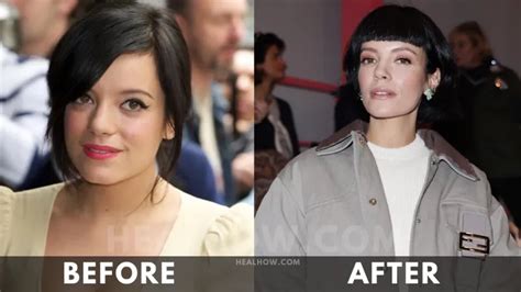 Lily Allen Weight Loss 2024 Before And After