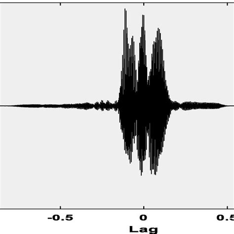 Illustration Speech Signal And Spectrogram Normal Speaker Timit
