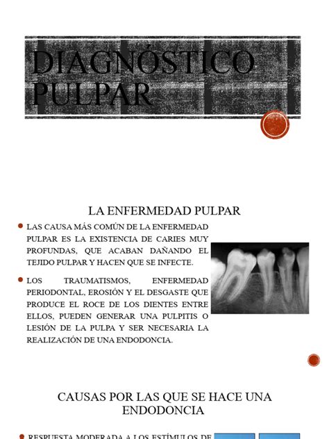 Diagnostico Pulpar Pdf Enfermedades Y Trastornos Medicina