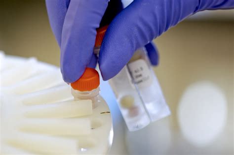 Fda Approves First Dna Based Test For Colon Cancer