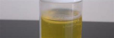 36 best Protein in Urine images on Pinterest | Box, Cleveland clinic ...