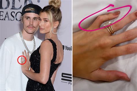 Hailey Baldwin Reveals She Suffers From Rare Genetic Disorder That Created Her Crooked Pinkies