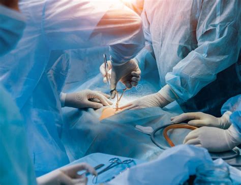 proceso de operación ginecológica de cirugía utilizando equipo laparoscopic foto de archivo