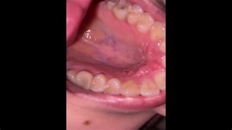 Mouth Tour Uvula And Teeth