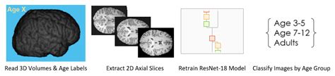 Brain Mri Age Classification Using Deep Learning File Exchange Matlab Central