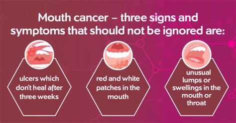 mouth and throat cancers thamesvalleycanceralliance nhs uk