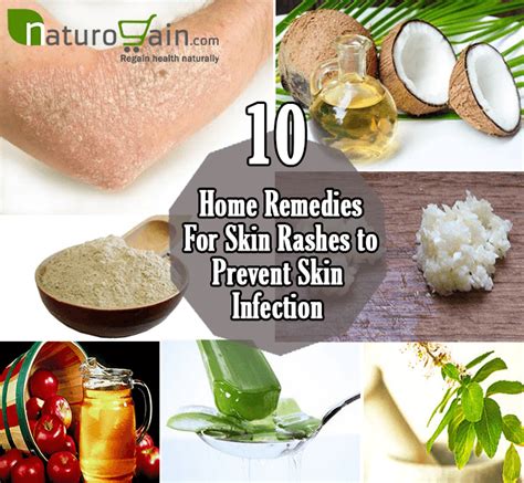 The Best Home Remedies For Skin Rashes The Healthy