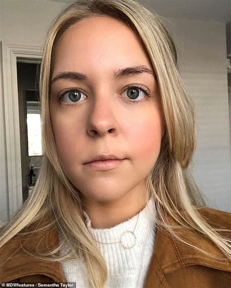 Woman 25 Is Left With A Droopy Face After Surgery To Remove A Brain Tumour Caused A Stroke
