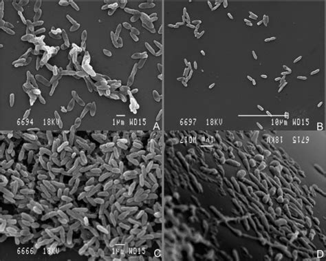 Scanning Electron Microscopy Images Of Pseudomonas Aeruginosa Isolates