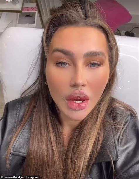Lauren Goodger Shows Off Her New Plump Pout After Undergoing The Same Butterfly Effect Lip