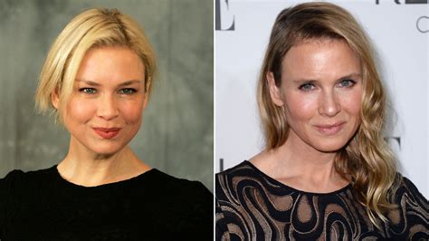 Renee Zellweger Before And After Plastic Surgery To See Her Dramatic Transformation The Hub