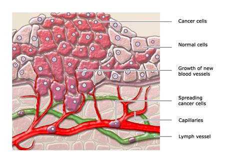 How Do Cancer Cells Grow And Spread
