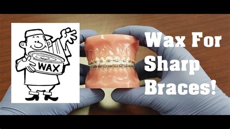 Tutorial How To Put Wax On Braces For Poking Wires Hooks Broken