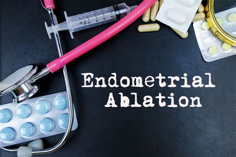 What Are The Pros And Cons Of Endometrial Ablation Andrew Krinsky