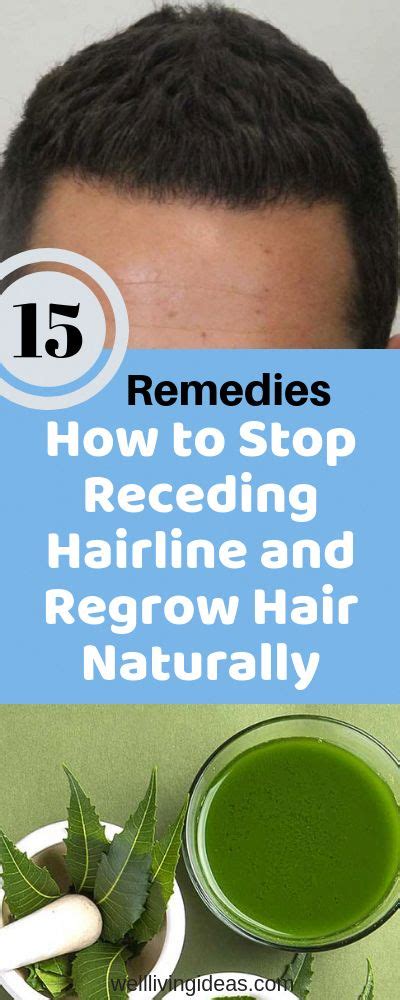 Hence, it works as the best home remedies to prevent hair loss problems. 15 Home Remedies to Stop Receding Hairline and Regrow Hair ...