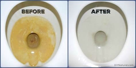 How To Remove Water Ring Stain In Toilet Bowl Howotremvo