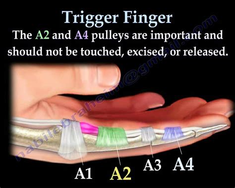 Hand Anatomy Tendon