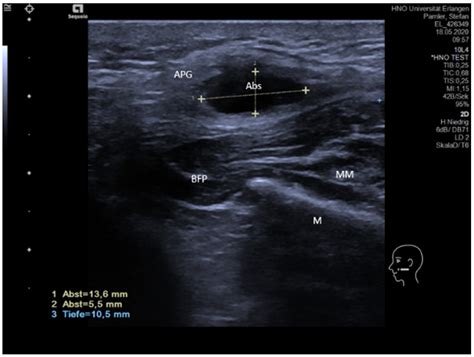 Jcm Free Full Text Ultrasound In Inflammatory And Obstructive