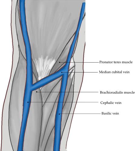 5 Upper Limb Anesthesia Key