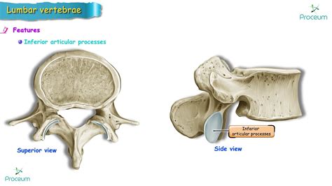 Anatomy Of Lumbar Vertebrae Osteology Usmle Typical And Atypical