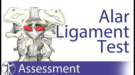 Alar Ligament Stress Test Upper Cervical Spine Instability Youtube