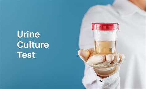 Urine Culture Test