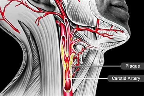 A Visual Guide To Vein And Artery Problems