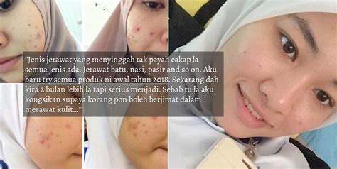 Produk hair treatment terbaik