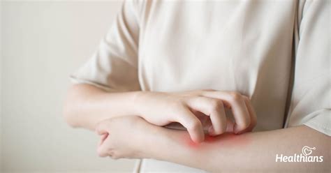 How Do You Treat Winter Eczema Flare Ups Healthians Blog