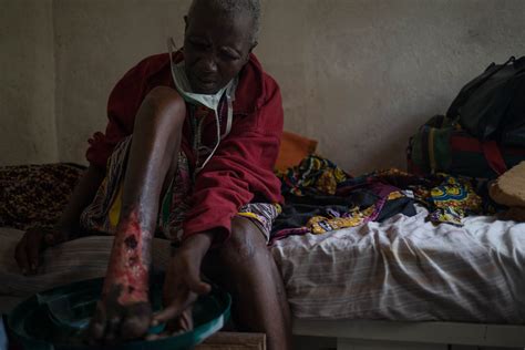 The Hospital In Cameroon Trying To Heal Old Wounds Cameroon Al Jazeera