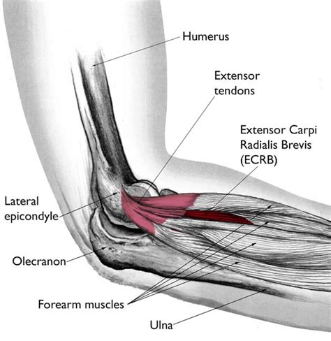 The heads of the biceps attach to two points in the upper arm to the coracoid process of the scapula and the glenoid fossa of the shoulder blade (where the humeral head attaches); You don't have to be a tennis player to get tennis elbow ...