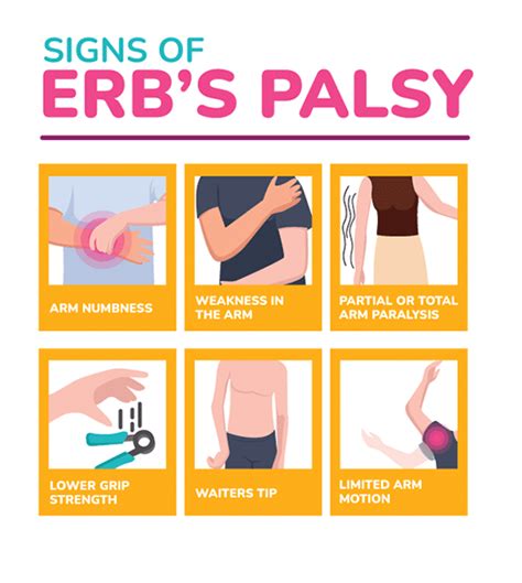 Erbs Palsy Birth Injury Center