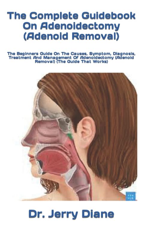 Buy The Complete Guidebook On Adenoidectomy Adenoid Removal The