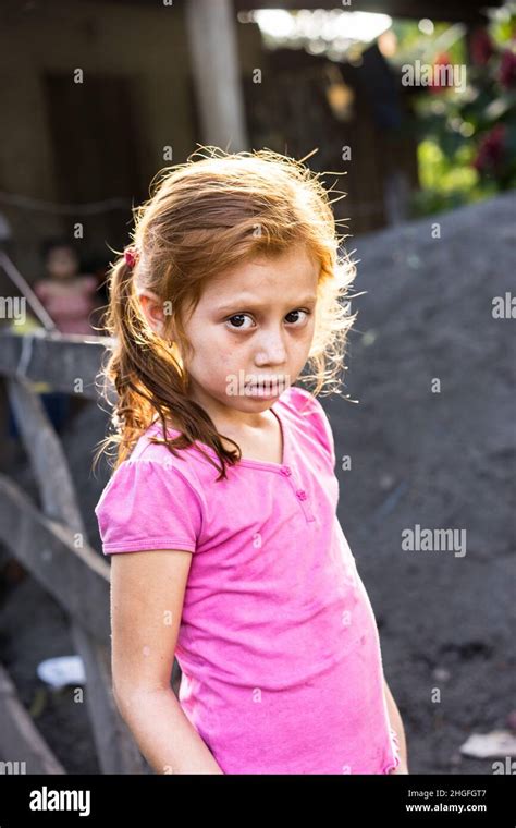 Pre Teen Red Haired Country Girl Looking At The Camera Hi Res Stock