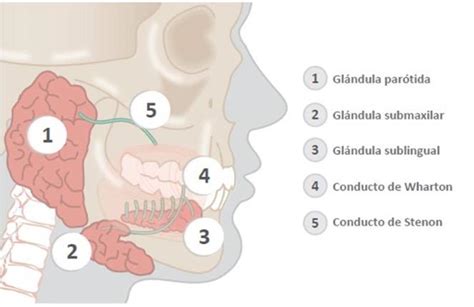 La Sialoadenitis Obstructiva Crónica Qué Es Y Cómo Se Trata