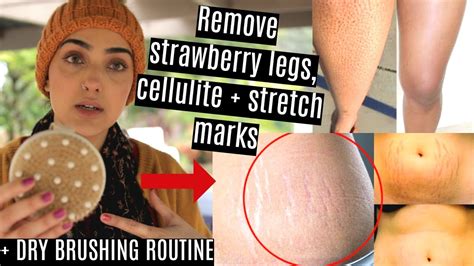 This involves the use of hot wax or strips which are applied on the leg then pulled off. DIY Body Polish To REMOVE: STRETCH MARKS, STRAWBERRY LEGS ...