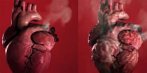 Smoking Can Cause Heart Disease And Strokes World Health