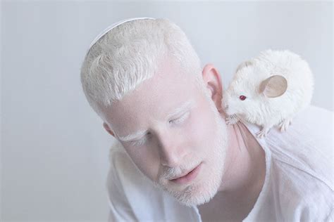 Fotos Que Muestran La Belleza De Personas Con Albinismo