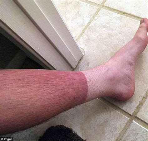 Are These The Worst Sun Tan Fails Ever Daily Mail Online