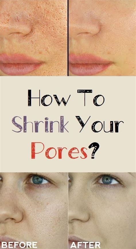 How To Shrink Your Pores Pore Clogged Pores Tighten Pores
