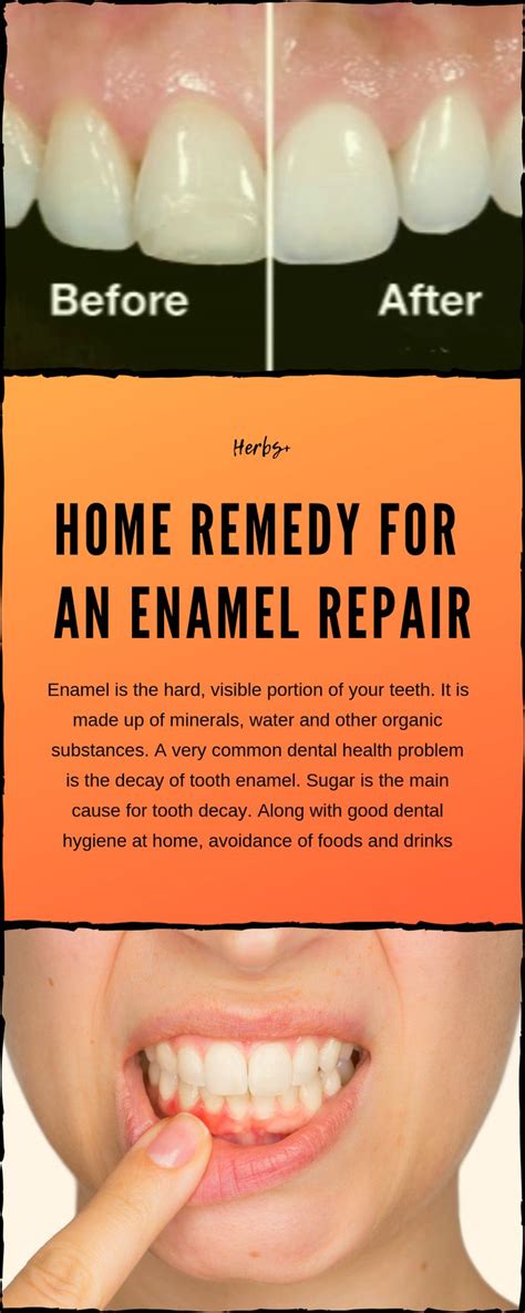 Home Remedy For An Enamel Repair Tooth Enamel Repair Tooth Enamel