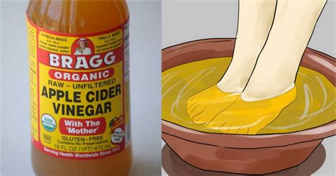 Soak Your Feet In Apple Cider Vinegar And Get These Incredible Results