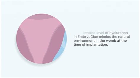 Embryoglue Helping Your Embryos To Implant Youtube
