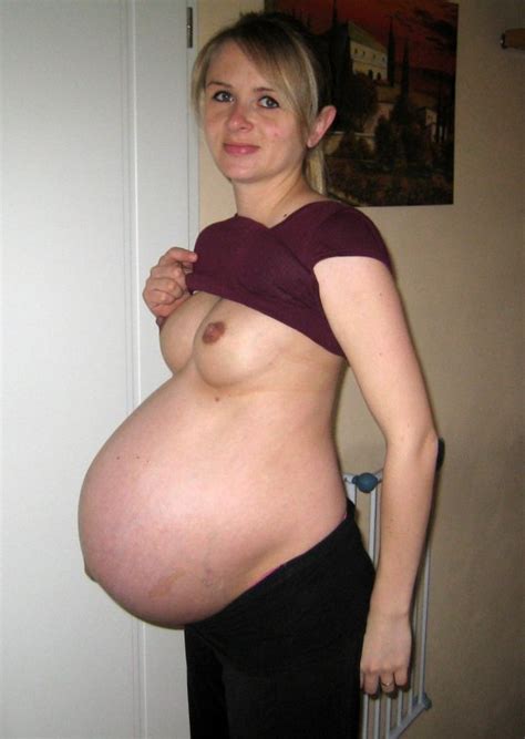 Abdominal Pregnancy