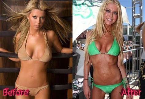 Tara Reid Plastic Surgery The Unnatural Look Of Tara