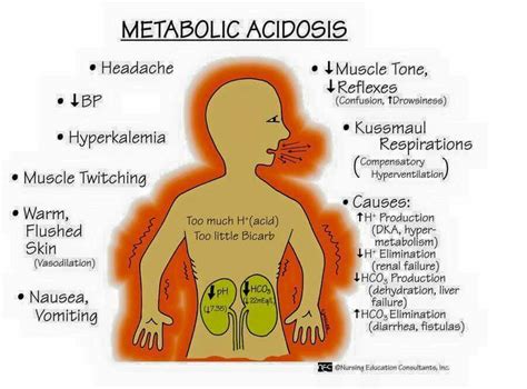 Metabolic Acidosis Nursing Mnemonics Nursing School Survival Metabolic Acidosis