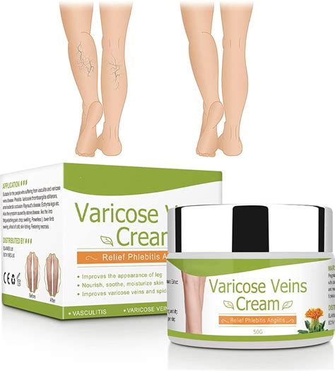 Varicose Veins Cream For Legs Veins Herbal Ointment Relief Phlebitis