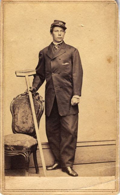 Ca 1860 80s Carte De Visite Portrait Of A Wounded